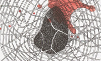 Blood Clot In The Brain